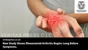 New Study Shows Rheumatoid Arthritis Begins Long Before Symptoms.