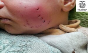 GAZA: Rat Bite Leaves Newborn Injured In Gaza As Siege Conditions Push Civilians To The Brink.