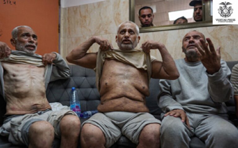 GAZA: Israel Releases 15 Gaza Detainees Showing Signs Of Torture And Starvation: Bodies As Evidence Of Systematic Abuse In Israeli Prisons.